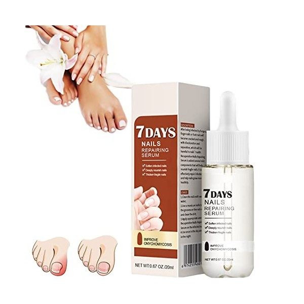 GFOUK 7 Days Nail Growth And Strengthening Serum,Fungal Nail Treatment Serum, Nail Strengthening Treatment, Stronger Nails in