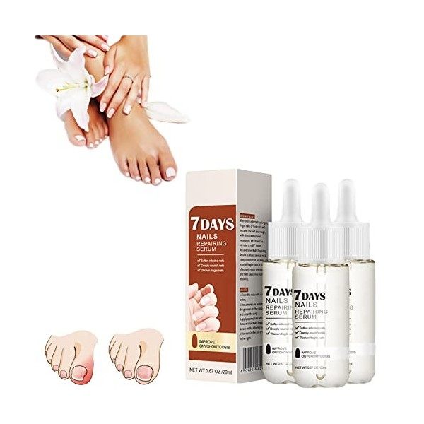 GFOUK 7 Days Nail Growth And Strengthening Serum,Fungal Nail Treatment Serum, Nail Strengthening Treatment, Stronger Nails in