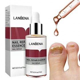 LANBENA Nail Repair Essence Serum Fungus Treatment Nail Removal Onychomycosis Toe Nail Glow Nourishing Care Hand and Feet Car