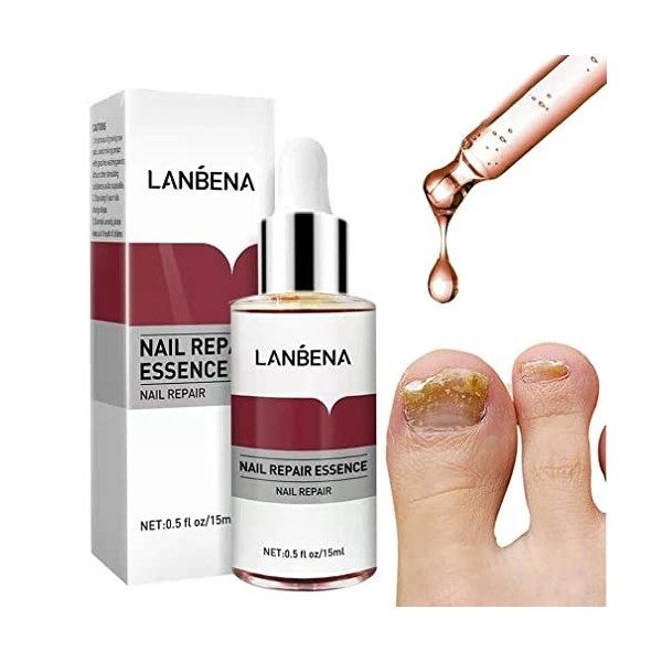 LANBENA Nail Repair Essence Serum Fungus Treatment Nail Removal Onychomycosis Toe Nail Glow Nourishing Care Hand and Feet Car