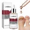 LANBENA Nail Repair Essence Serum Fungus Treatment Nail Removal Onychomycosis Toe Nail Glow Nourishing Care Hand and Feet Car