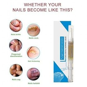 5Pcs Okita Toenail Fungus Pen,Nail Repair,Nail Fungus Treatment for Toenail Pen,Fix & Renew Damaged, Broken, Cracked Nails