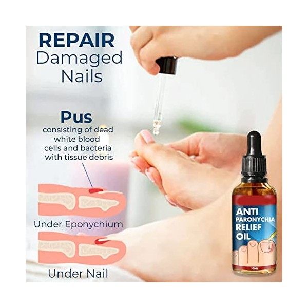 German ToenailPlus Anti Paronychia Relief Oil, Toenail Anti Paronychia Relief Oil, Toe and Fingernail Repair for Damaged Disc