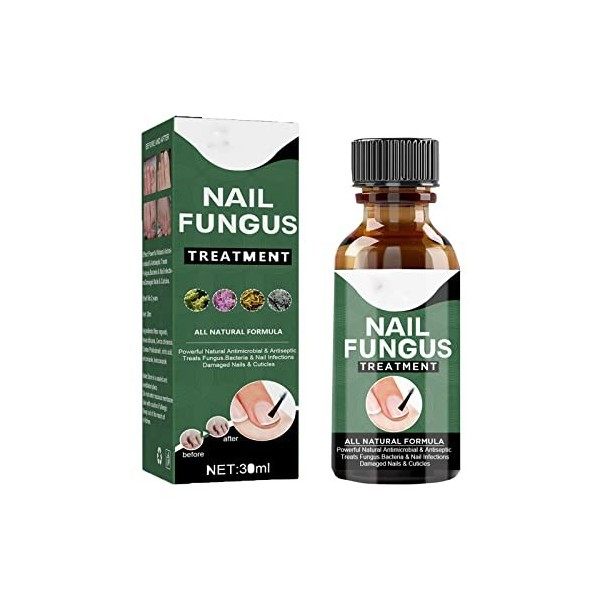 Nail Fungal Treatment In Singapore | Dr. Noor Hanif Said
