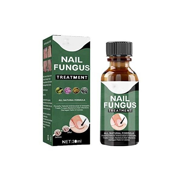 Toenail Fungus Treatment Extra Strength,Nail Fungus Solution,Footfree Antifungal ， Fingernail & Toenail Solution - Fix & Rene