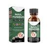 Toenail Fungus Treatment Extra Strength,Nail Fungus Solution,Footfree Antifungal ， Fingernail & Toenail Solution - Fix & Rene