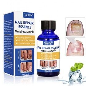 Mycose Ongles Des Pieds,Mycose Ongle,Traitement Mycose Ongle Pied,Traitement Ongles,Solution Pour Les Ongles Décolorés,Épaiss