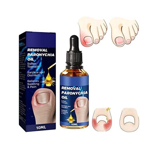 LPSHGK German Toenailcare Removal Paronychia Oil, German Toenail Care Paronychia Oil, German Toenail Care Removal Paronychia 