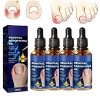 LPSHGK German Toenailcare Removal Paronychia Oil, German Toenail Care Paronychia Oil, German Toenail Care Removal Paronychia 