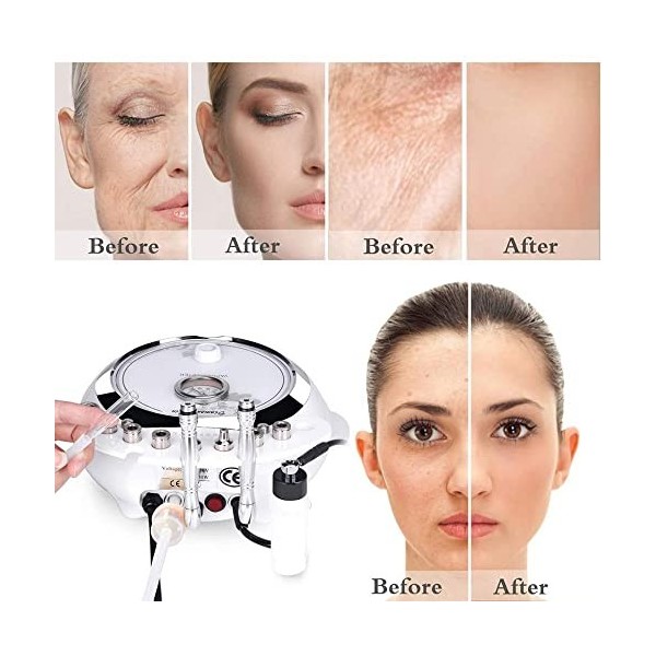 Multifonctionnel beauté santé 3 en 1 machine hydrafaciale nettoyant les rides enlever la peau blanchissant visage raffermissa