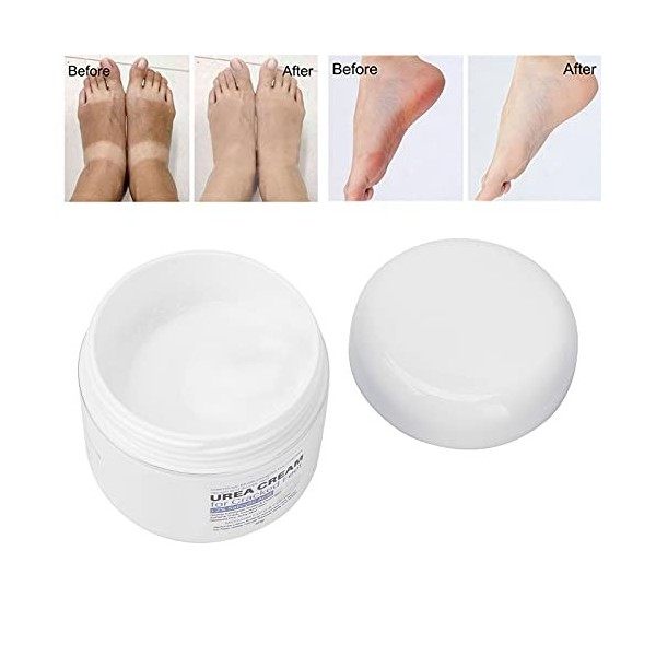 Alaaner LANTHOME Crème Durée Acide Salicylique Crème Anti-callosités pour Les Pieds Secs et Fissurés 50 ML