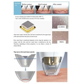 Machine thermique de rajeunissement de la peau fractionnelle à deux poignées