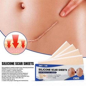 Nrkin Retrait de la cicatrice de la feuille de Silicone, Patch Silicone Traitement des cicatrices en Gel pour les blessures c