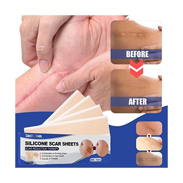 NOWAYTOSTART Feuilles de Cicatrice en Silicone - Feuilles de Silicone Extra Larges pour enlever Les Cicatrices - Bandes de Ci