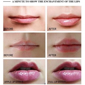 Électrique À Lèvres Repulpeurs Instrument Formateur, Appareil Automatique Beauté Portable Avec Chargement USB, Rendre Vos Lèv