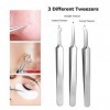 Pinkiou Outils de suppression des points noirs Acné Blemish Pimple Extractor Aiguille Facial Blackhead Comedone Clip Pince à 