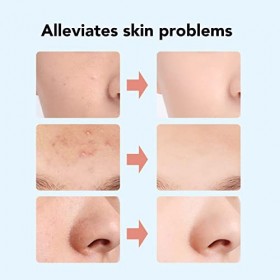 Patch éclaircissant pour Boutons 60 Pièces