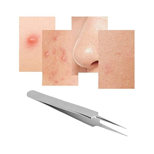 Pimple Popper Tool, Outil de Suppression de Comédons à Tête Droite en Acier Inoxydable Extracteur de Points Noirs Extracteur 