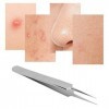 Pimple Popper Tool, Outil de Suppression de Comédons à Tête Droite en Acier Inoxydable Extracteur de Points Noirs Extracteur 