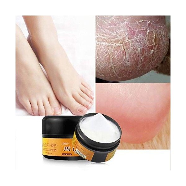 Allbestaye Huile de cheval Réparation Main Pied Se Soucier Exfoliant Crème Anti Engelures Sec Fissures Et Fissures Guérir Pom