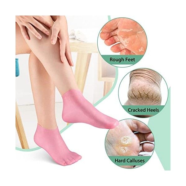 Noverlife Lot de 2 paires de chaussettes hydratantes en silicone antidérapantes à laloès pour pieds secs et fissurés et chau