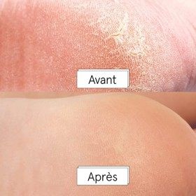 Masque De Pelage Des Pieds - Végétalien - Dr. Pedicure Masque de pelage pour les pieds secs et crevassés Unscented, 2 Pair 