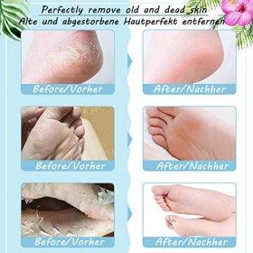 Skymore Masque Pieds - 2 Paires Masque pour Peeling Pied, pour Soin des Pieds, Efficace pour les Callosités, pour Pieds Rugue