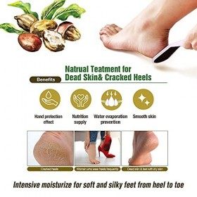 epielle Lot de 10 paires de chaussettes et gants hydratants pour le soin des mains et des pieds 5 gants et 5 chaussettes 