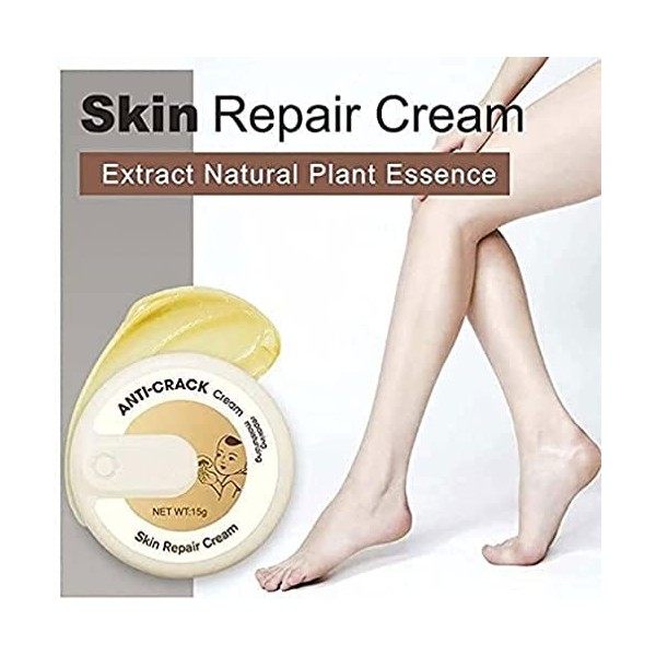 Crème anti-déchirure pour peau dhiver, Réparation Main Pied Se Soucier Exfoliant Crème Anti Engelures Sec Fissures Et Fissur