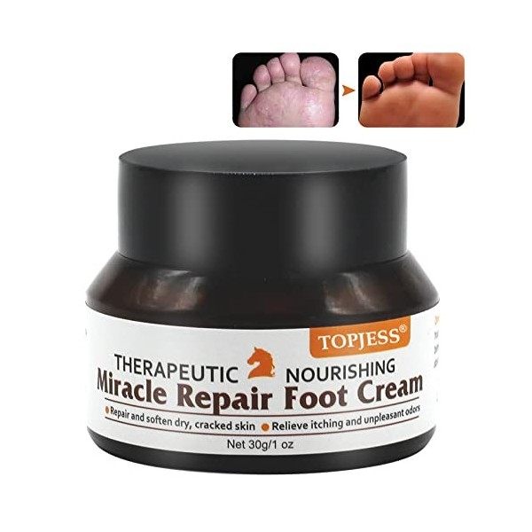 Creme de pied dathlete, Crème à lhuile de cheval, Anti fongique creme, Anti fungal, traite efficacement le pied du pied, gu