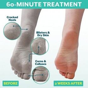 patchology PoshPeel Pedi Cure