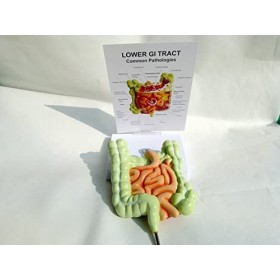 modèle Gastro-intestinal, modèle de lésion colorectale, maladie intestinale, modèle de pathologie intestinale