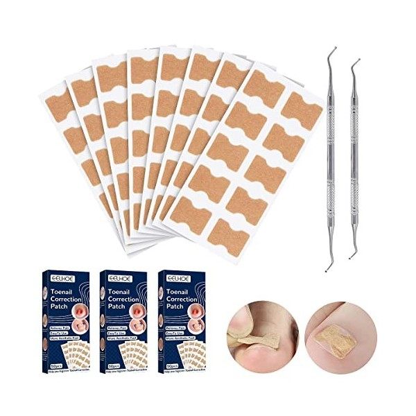 Ensemble Doutils pour Ongles Incarnés avec 150 pièces Patch de Correction et 2 pièces Lime à Ongles dorteils, Autocollant C