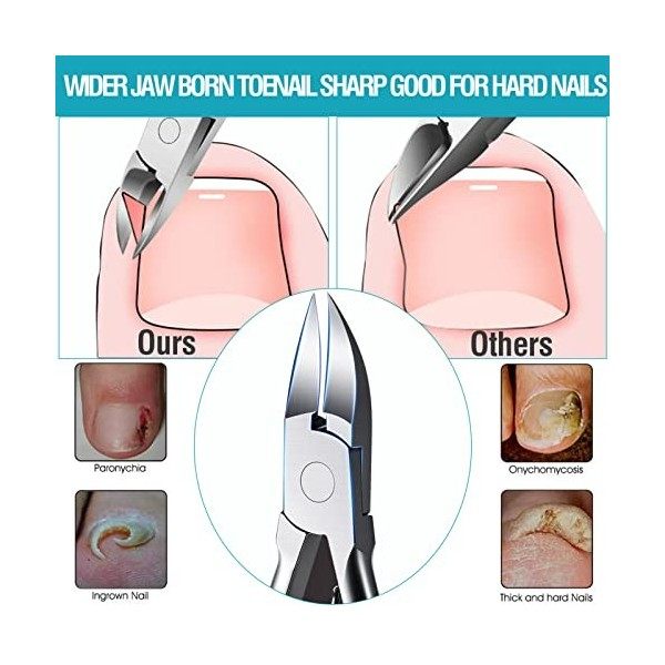 TOKINGO Kit de coupe-ongles professionnel robuste pour ongles épais incarnés, cadeau danniversaire pour homme et femme, outi