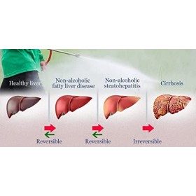 panihari HEPTAWIT AYURVEDIC Sirop de foie pour une protection complète du foie saine 150 ml