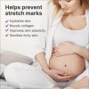 Maternity Stretch Mark Prevention