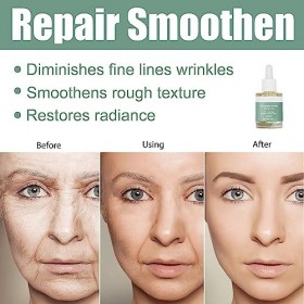 Tkekruh Anti-Âge Sérum Hyalurogel,Anti-Vieillissement,Acide Hyaluronique Pur Serum Visage Hydrate Visage Profondeur,Réduit L