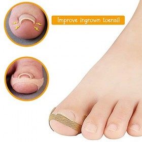 Autocollants de Correction des Ongles 40Pcs Traitement dongle de Paronychia Récupérer Ruban Adhésif dOngle Incarné Autocoll