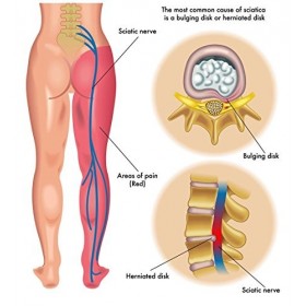 Flekosteel warming body balm Lot de 3 Tubes de baume Chauffant pour Le Corps 150 ML TOTAL
