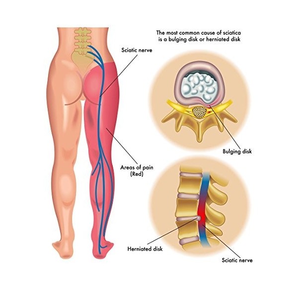 Flekosteel warming body balm Lot de 3 Tubes de baume Chauffant pour Le Corps 150 ML TOTAL