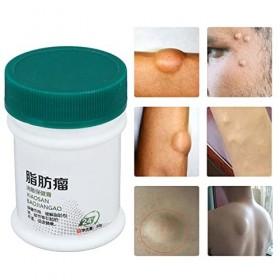 Pommade délimination des Lipomes, Crème délimination des Lipomes Inflammatoires Libérant des Douleurs Absorbables pour la M