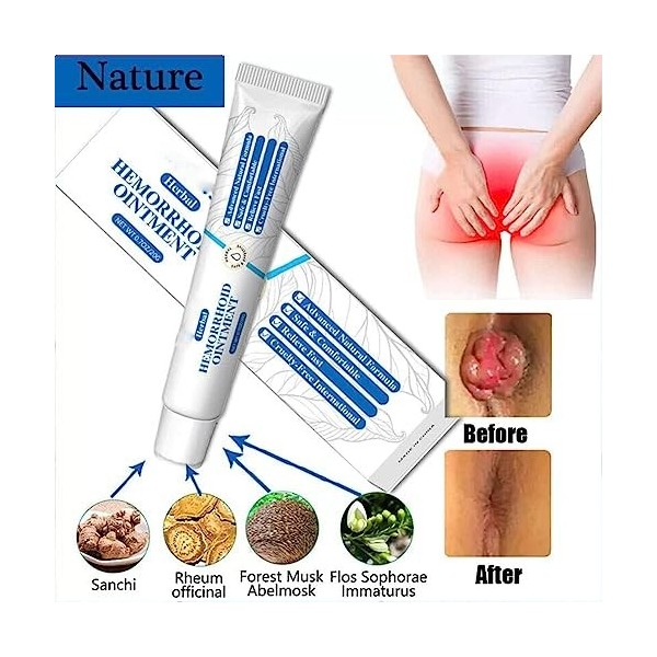 Natural Herbal Hemorrhoids Ointment,Organic Herbal Hemorrhoid Cream,Hemorrhoid Ointment,Soothes Swelling for All Skin Type 3