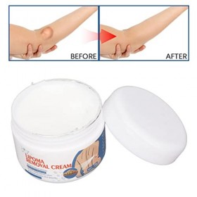 Crème délimination des Lipomes, Crème de Traitement des Lipomes pour Prévenir les Inflammations et Améliorer la Circulation 