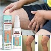 KOAHDE Gel pour Varices pour les Jambe,Varices Traitement Jambe Gel,Gels Contre les Varices,Gels pour Varices pour Veines,Crè