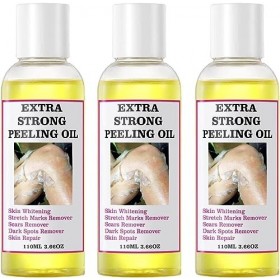 Huile Peeling Extra Forte,Huile Peeling Pour Le Corps, Peeling Jaune Sûre Extra-Forte, Gommage Puissante, Pour Le Corps Contr