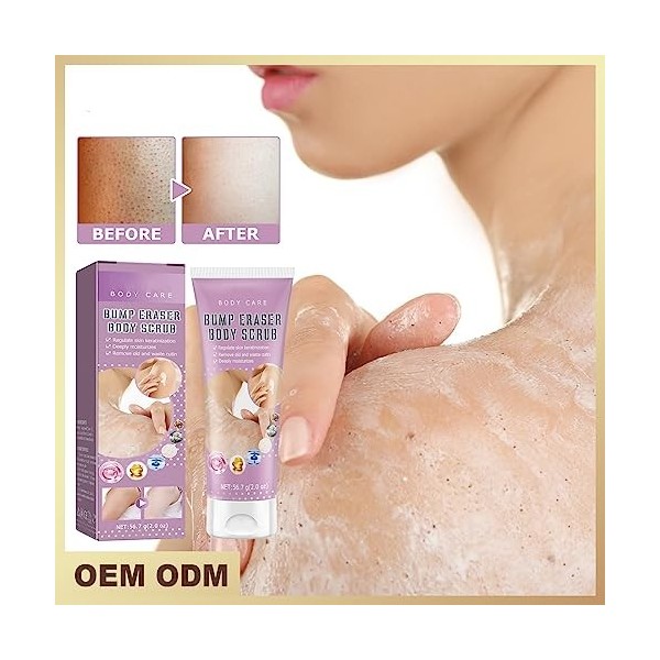 Ninge First Aid Beauty Body Scrub Bump Moisturizing Body Peeling, Utilisé pour contrôler lhuile, exfolier et éliminer lacné