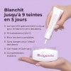 Kit de blanchiment des dents Onlysmile professionnel | Kit de blanchiment dentaire pour des dents blanches avec effet immédia