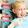 2 Paires Faux Dentier Sourire Parfait, Dent Provisoire Fausse Dent Dentier Amovible Haut et Bas, Facette Prothese Dentaire, F