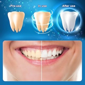 Blanchiment Dentaire 28 Bande de Blanchiment des Dents, Non Sensible 14 Ensembles Bandes de Blanchiment Instantané Profession