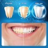 Blanchiment Dentaire 28 Bande de Blanchiment des Dents, Non Sensible 14 Ensembles Bandes de Blanchiment Instantané Profession